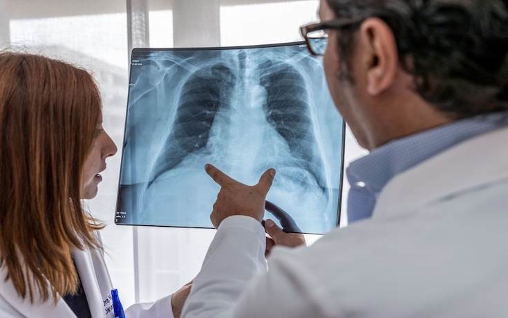 médecins regardant une radiographie de contrôle