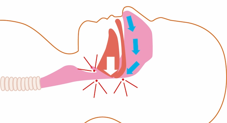 ""