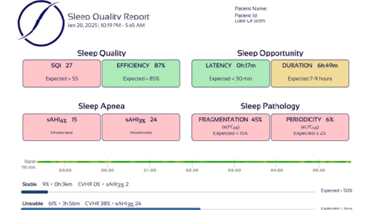 Sleep Quality Report