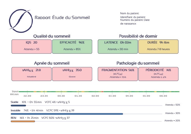 Rapport Étude du Sommeil