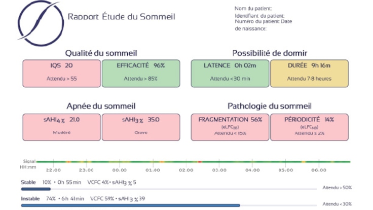 Rapport Étude du Sommeil